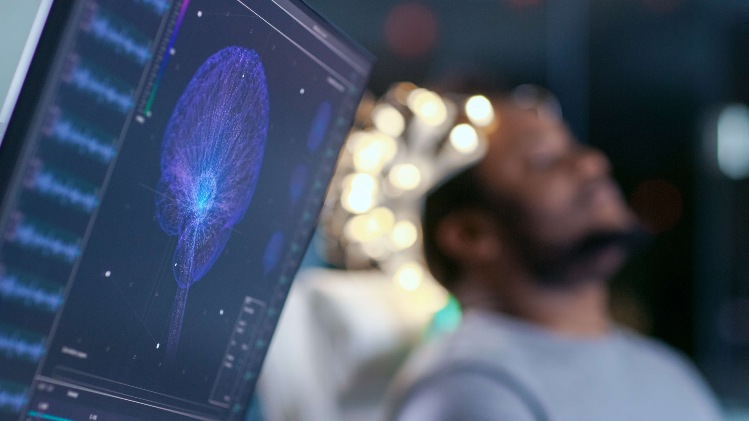 Stroke Misdiagnosis Claims